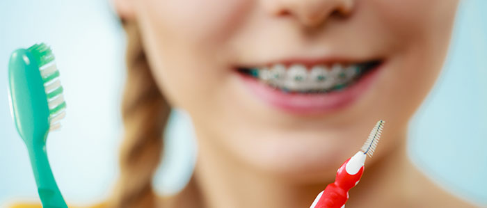 Gesunde Zähne mit Zahnspange, Datteln