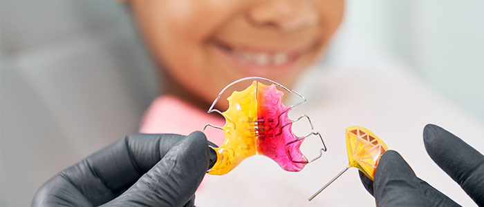 Lose Zahnspangen für Kinder in Datteln