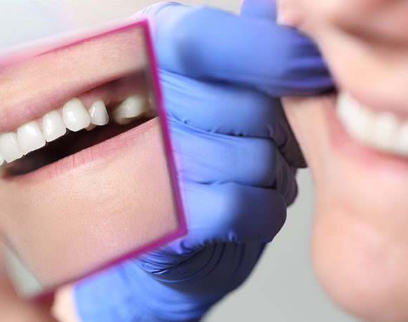 Kieferorthopädie vor Zahnersatz